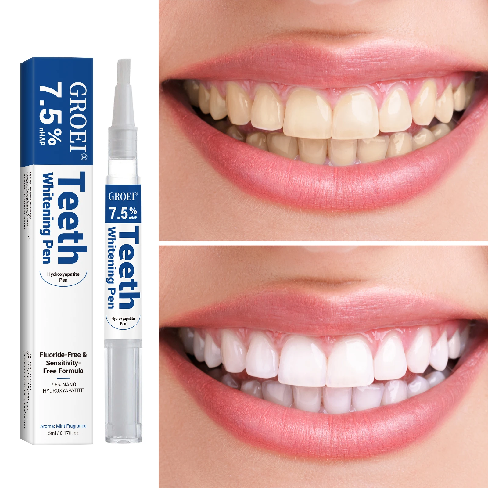 Stylo de blanchiment des dents - Teeth Whitening Near Me avis et prix