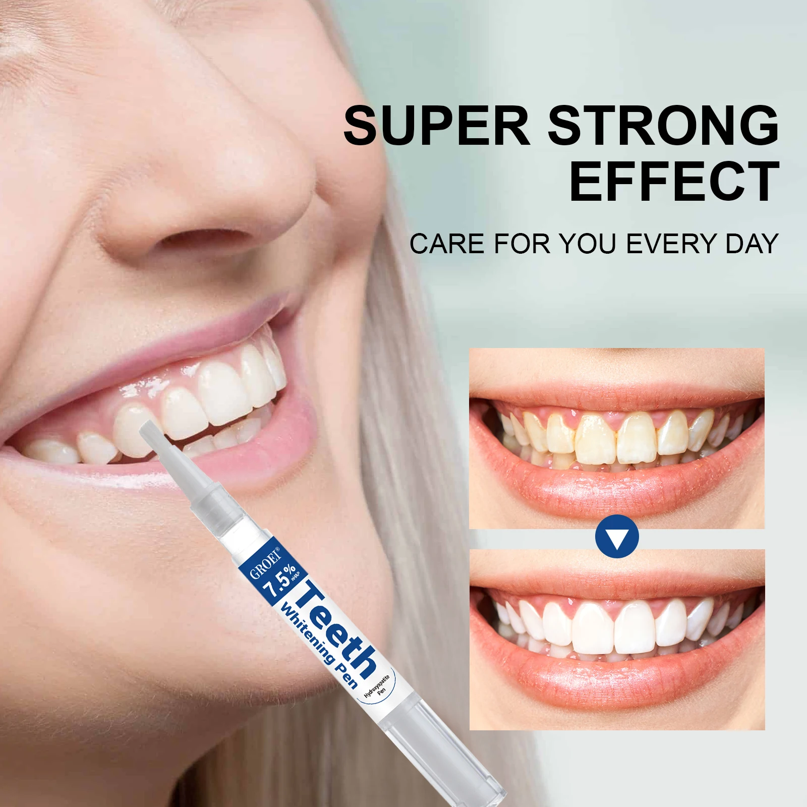 Stylo de blanchiment des dents - Teeth Whitening Near Me avis et prix
