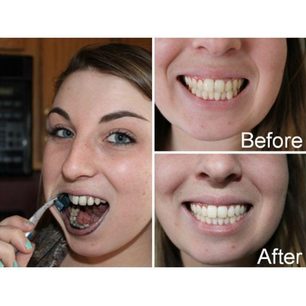 Poudre de charbon de bambou po - Teeth Whitening Near Me avis et prix