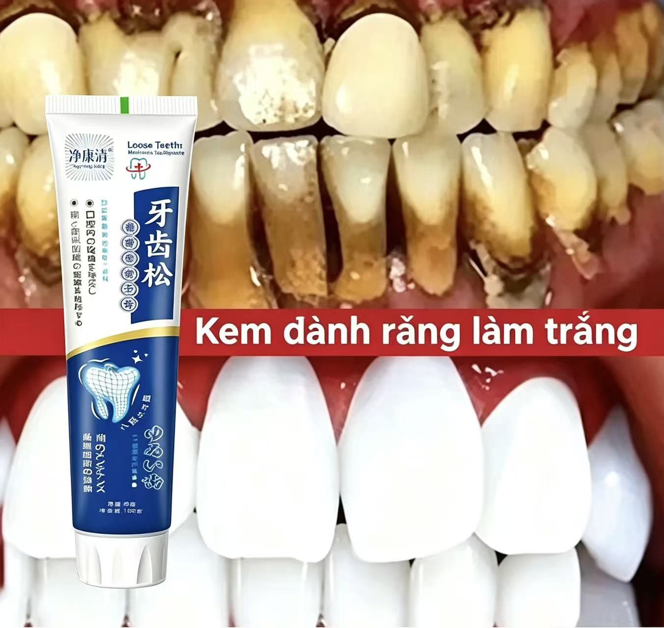 Dentifrice Japonais Importé po - Teeth Whitening Japanese avis et prix