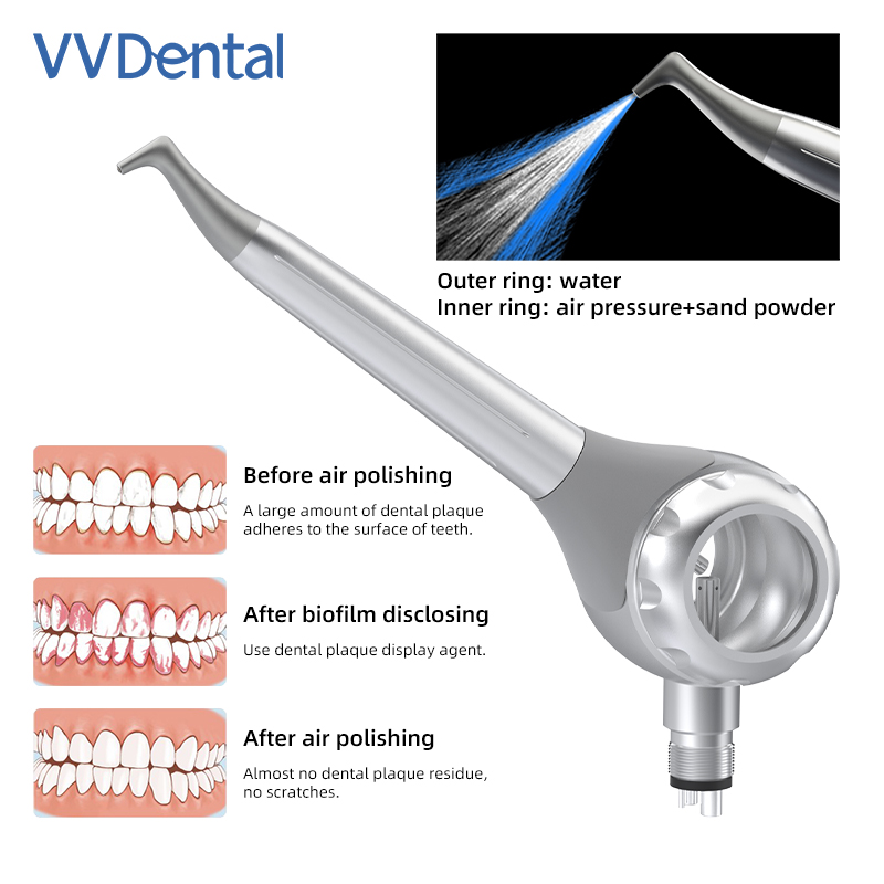 Pistolet de sablage dentaire V - Teeth Whitening Usa avis et prix