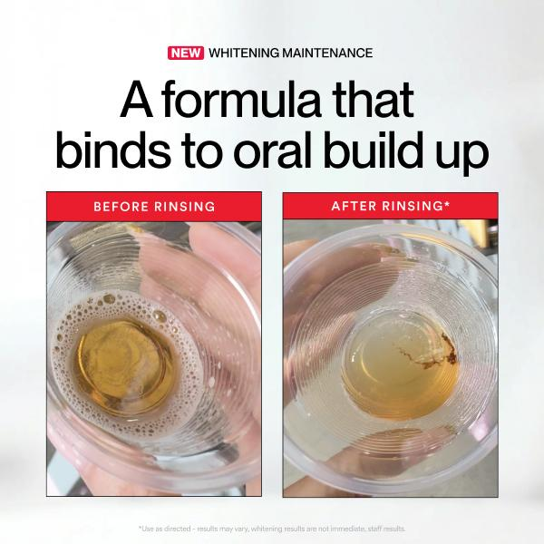Hismile ID Bain de bouche blan - Teeth Whitening Mouthwash avis et prix