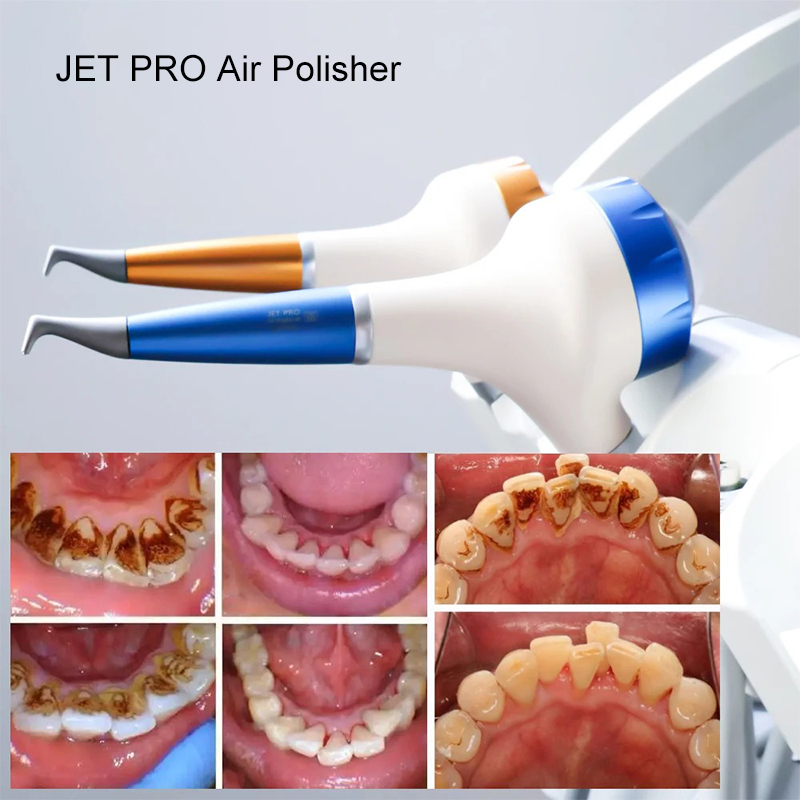 VV Dental Air Polishing Prophy - Teeth Whitening Usa avis et prix