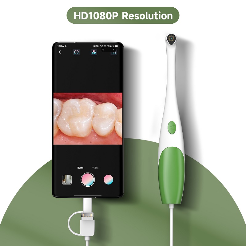 Endoscope buccal TYPE-C, camér - Teeth Whitening Video avis et prix