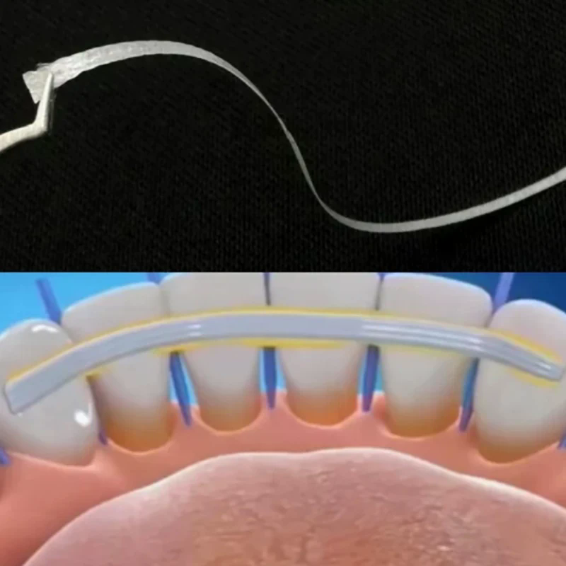 1 pièce Bande de fibre dentair - Teeth Whitening Strips Lumineux avis et prix